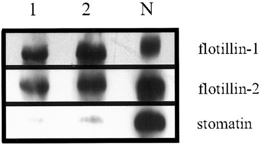 Fig. 2. Identification of stomatin, flotillin-1, and flotillin-2 in normal and OHSt erythrocyte membranes. / Erythrocytes from a healthy donor (N) and 2 OHSt patients (1,2) were hypotonically lysed, and the prepared ghosts were analyzed by Western blotting, as indicated.