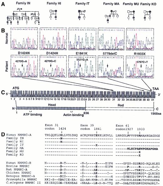 Fig. 1. NMMHC-A mutational analysis. / (A) Affected or unaffected individuals are represented by filled or open symbols, respectively. Mutation status indicated by −, wild-type homozygote; +, mutant heterozygote. (B) The portions of the representative electropherograms illustrate the 5 heterozygous nucleotide changes. Forward sequence is shown from families IN, HI, and IT, and reverse sequence from families MA, MU, and KO. In each panel, the normal sequence is shown at the top, and the mutated sequence is shown at the bottom. The mutated position is indicated by arrows. (C) Schematic representations of 41 exons of NMMHC-A are shown at the top, and the predicted amino acid of NMMHC-A at the bottom. The amino terminal globular head domain is shaded and the carboxyl terminal rod domain is not. The transcription initiation codon (ATG), natural stop codon (TAA), ATP-binding domain and actin-binding domain are indicated. (D) NMMHC-A sequence alignment. Amino acid sequence alignment is shown from the 2 human NMMHC isoforms and the known NMMHC from the other species. The amino acid alterations in each of the 6 families are indicated in bold. D1424N, D1424H, E1841K, and R1933X mutations occur at highly conserved residues of the protein. In family MA, 5779delC mutation causes a frameshift and a premature termination at 20 amino acids downstream of the mutation.