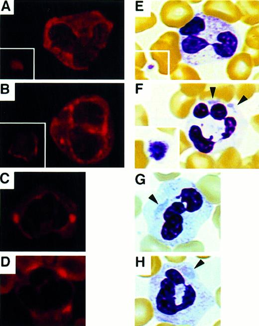 Fig. 2. NMMHC-A localization in platelets and neutrophils. / Immunofluorescence micrographs of peripheral blood smears stained with anti-NMMHC-A antibody (A-D) and May-Grünwald-Giemsa-stained smears (E-H). (A,E) Control platelets (inset) and neutrophils. (B,F) Platelets (inset) and neutrophils of a patient from family IN. (C,G) Neutrophils of a patient from family MA. (D,H) Neutrophils of a patient from family MU. Inclusion bodies in neutrophils are indicated by arrowheads. (Original magnification × 400)