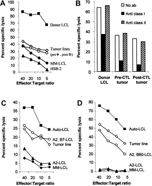 Fig. 2. The tumor lines are less sensitive to killing by HLA class I–restricted CTLs, even though they have no defect in antigen presentation. / (A) The tumor lines are less sensitive to killing than the donor LCLs. To compare the sensitivity of donor-derived B95-8 virus–transformed B-cell line and the recipient-derived tumor cell lines to killing by the donor CTL line, donor CTLs were incubated with51Cr-labeled target cells for 4 hours in a standard chromium release assay at the effector:target ratios indicated. The target cells were the B95-8 virus–transformed donor LCLs, the patient-derived tumor lines that grew spontaneously from patient blood before and 7 days after CTL infusion, an HLA mismatched LCL (MM-LCL), and the LAK cell–sensitive target, HSB-2. (B) Antitumor activity was HLA-restricted. To determine whether the antitumor activity of the CTL line was due to CTL or LAK cell activity, target cells were incubated with standard blocking antibodies to HLA class I (W6/32) and class II (CR3/43). After 30 minutes of incubation, effector cells were added at an effector:target ratio of 10:1. After 4 hours, the plates were harvested and the percent chromium release calculated. Killing of both tumor lines was HLA class I–restricted. (C) The tumor line is killed through HLA-B7. CHJ is HLA-matched at HLA loci A2, B7 with the donor. In a standard cytotoxicity assay, CHJ CTLs kill the pre-CTL tumor line with similar efficiency as they kill normal LCLs that share only A2 and B7. The killing is likely specific for B7 because LCLs that only match at A2 are not killed. (D) The tumor line is killed through HLA-B60. RF is HLA-matched at HLA loci A2, B60 with the donor. In a standard cytotoxicity assay, RF-CTLs kill the pre-CTL tumor line with similar efficiency as they kill normal LCLs that share A2 and B60. The killing is likely specific for B60 because LCLs who only match A2 are not killed.