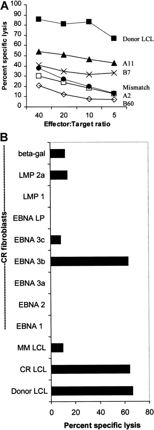 Fig. 3. The donor CTL line was restricted through HLA-A11 and specific for EBNA-3B. / (A) The donor CTL line was tested for its ability to kill B95-8–derived LCLs from individuals who shared only one of each of its HLA class I antigens. Killing is shown across a range of effector:target ratios and was restricted mostly through HLA-A11. Killing through A2 and B60 was less than killing of an HLA class I MM-LCL. (B) The donor CTL line was EBNA-3B–specific. The donor, CR, shared HLA-A2, -A11, and -B7 with the CTL donor. This chromium release assay shows that the CR-LCLs and the donor LCLs were equally sensitive to killing by the donor CTL line. CR-derived dermal fibroblasts were infected with vaccinia virus recombinants expressing EBNAs 1, 2, 3A, 3B, 3C and LP as well as LMP1, LMP2, and the Escherichia coli–derived β-galactosidase gene. Only killing of EBNA-3B–expressing fibroblasts was greater than background killing of β-galactosidase–expressing fibroblasts.