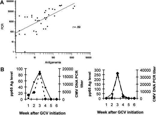 Fig. 1. Correlation between pp65 antigenemia levels and copies of CMV DNA detected by quantitative TaqMan PCR of plasma. / (A) Banked plasma samples from a subset of 10 consecutive patients with antigenemia increases of greater than 5× baseline were tested for CMV DNA. Log-transformed quantities of the number of pp65 Ag staining cells and number of copies of CMV DNA per milliliter plasma are highly correlated (r = 0.69). (B) In two representative patients, the temporal rise and decline of CMV viral load as measured by pp65 antigenemia and CMV DNA are correlated. ▪ indicates pp65 Ag; ♦, PCR titer.
