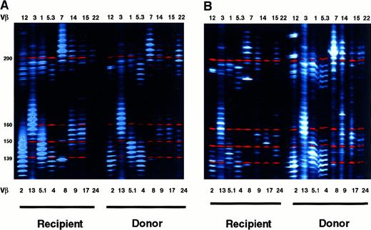 Fig. 5. TCR diversity of recipient or donor T cells. / Comparative analysis of TCR-Vβ CDR3 heterogeneity length in (A) CD8-depleted (CD8−) or (B) CD8-enriched (CD8+) lymphocyte suspensions derived 72 months after BMT from theWHN−/− recipient and theWHN+/− donor environment. RT-PCR was performed on RNA isolated from purified T-cell subsets. PCR products were separated on DNA sequencing polyacrylamide gel by using an automated ABI PRISM 377 apparatus (PerkinElmer). Band intensity was evaluated with the Gene Scan software. Size markers are indicated. TCR-Vβ families showing fewer than 5 major peaks were considered altered.