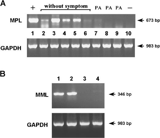 Fig. 5. Exogenous gene expression in mice treated with primary B cells infected with MPL-PURO vector virus-expressing PLP. / (A) RT-PCR was performed on total RNA extracted from the spleens of mice treated with MPL-PURO–infected B cells (lanes 2-7) and mice treated with B cells infected with the control vector MML-PURO (lanes 8 and 9). An untreated mouse was used as negative control (lane 10), and a MPL-PURO–infected WEHI 231 B-cell line was used as positive control (lane 1). PA indicates paralysis. (B) RT-PCR with the use of MML-specific primers was performed on total RNA extracted from the spleens of mice treated with MML-PURO–infected B cells, lanes 1 and 2. RNA extracted from the spleen of an untreated mouse (lane 3) and from MPL-PURO–infected WEHI 231 B cells (lane 4) were used as negative controls. For all samples, amplification of the housekeeping geneGAPDH was performed to ensure that equal levels of total RNA were used.