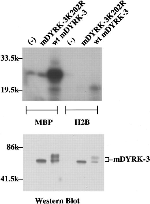Fig. 4. Phosphorylation of MBP by mDYRK-3 and apparent autophosphorylation in 293 fibroblasts. / To initially assess catalytic activity, mDYRK-3 (and the type II subdomain mutant mDYRK-3–K202R) were expressed transiently as Myc epitope–tagged constructs in 293 cells. At 48 hours posttransfection, mAb 9E10 immunoprecipitates were prepared from whole-cell lysates and were used together with 32P γATP plus MBP or histone 2B (H2B) in in vitro kinase assays. Shown in the upper panel are electrophoresed and autoradiographed 32P products. Immunoprecipitates were also eluted, and epitope-tagged wild-type mDYRK-3 and mDYRK-3–K202R were assayed by Western blotting (lower panel). Indexed are 2 forms of mDYRK-3 (ie, molecular-weight 68 000 and 70 000 forms), and the positions of molecular-weight standards.