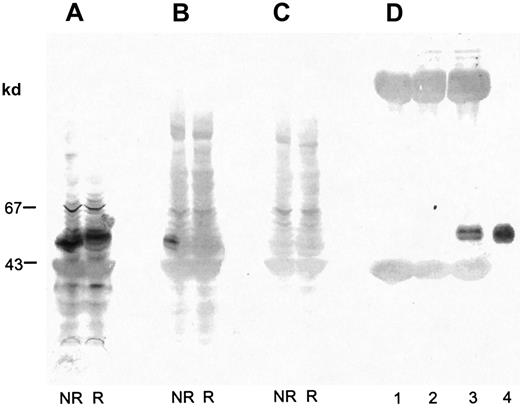 Fig. 4. Binding of biotinylated alboaggregin A to platelet lysate. / Platelet lysate was separated by SDS-PAGE (7%-17% acrylamide gradient) and transferred to PVDF membranes. Proteins were incubated with (A) anti-GPVI Ab followed by antirabbit IgG–coupled alkaline phosphatase, (B) biotinylated alboaggregin A and avidin-coupled alkaline phosphatase, or (C) avidin-coupled alkaline phosphatase and detected with BCIP and NBT. (D) Proteins from platelet lysate immunoprecipitated with rabbit preimmune serum anti-GPVI (lane 1), rabbit anti-GPV Ab (lane 2), rabbit anti-GPVI Ab (lane 3), or isolated GPVI purified on a convulxin column (lane 4) was separated by SDS-PAGE (7%-17% acrylamide gradient) and transferred to PVDF membranes. The proteins were incubated with biotinylated alboaggregin A before detection with avidin-coupled alkaline phosphatase, BCIP, and NBT.