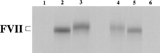 Fig. 2. In vitro transcription/translation of VIIWT and VIIMT. / In vitro transcription/translation in a rabbit reticulocyte lysate system was completed with either no added DNA template (lanes 1 and 6) or with closed circular pT7VII plasmid (WT, lane 2; MT, lane 3), or with linearized pT7VII plasmid (WT, lane 5; MT, lane 4). Samples were analyzed on a 12% SDS-PAGE under reducing conditions. The difference in electrophoretic mobility is shown by arrows.