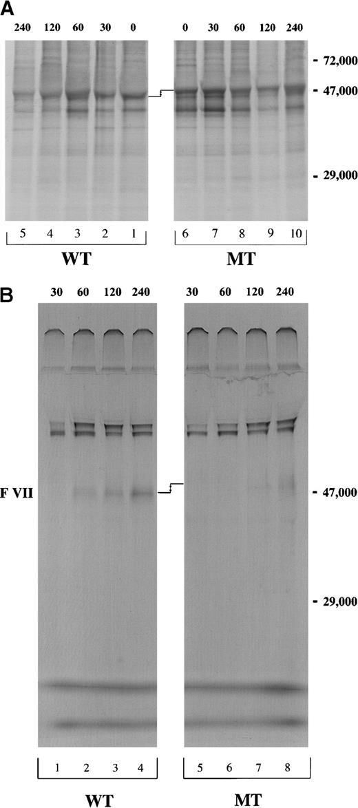 Fig. 3. Pulse-chase of cell lysate and conditioned media of the cells stably transfected with pEDVIIWT or pEDVIIMT. / After 15 minutes of pulse with 35S-methionine, cells were chased for 30, 60, 120, and 240 minutes. Equivalent amounts of (A) cell lysate and (B) conditioned media for both WT and MT constructs were immunoprecipitated using mAb1476 against VII and analyzed by 8% SDS-PAGE under nonreducing conditions. The molecular weight marker is localized at the right side of the figures. The difference in electrophoretic mobility is shown by arrows.