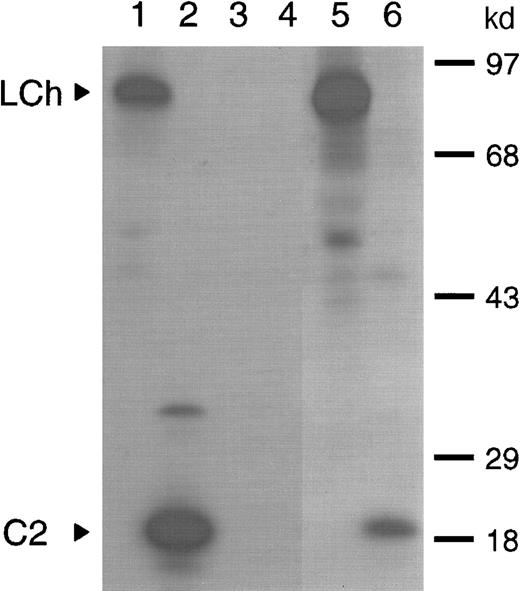 Fig. 1. Characterization of antibodies present in plasma of a patient with inhibitors to factor VIII. / Binding of antibodies to metabolically labeled factor VIII fragments corresponding to the factor VIII light chain and the C2 domain was evaluated by immunoprecipitation. The samples were analyzed under reducing conditions on a 12.5% (wt/vol) sodium dodecyl sulfate–polyacrylamide gel. (lanes 1 and 2) Positive control (CLB-CAg 117); (lanes 3 and 4) negative control (normal plasma); (lanes 5 and 6) patient's plasma. Arrowheads indicate C2 domain (C2) and factor VIII light chain (LCh). Molecular weight markers in kd are indicated at the right.