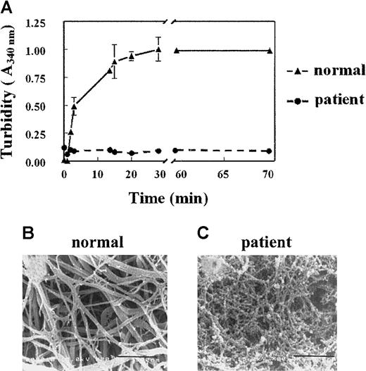 Fig. 1. Fibrin structure of fibrinNieuwegein. / (A) Plasma was clotted by the addition of 1 U/mL thrombin. Turbidity at 340 nm was measured in time. Triangles represent control plasma, and circles, plasmaNieuwegein. Data are expressed as mean ± SEM of duplicate experiments with duplicate wells. (B,C) Scanning electron microscopic analysis of the formed fibrin structure from normal plasma (B) and plasmaNieuwegein (C). Bars represent 900 nM.