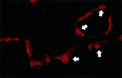 Fig. 4. Immunostaining for αv-integrins on the cell surface of hMVEC stimulated with bFGF/TNF-α. / After an incubation period of 5 days with bFGF/TNF-α, the fibrin matrices were sectioned and endothelial cells were stained for αv-integrins. Arrows point to endothelial cells present in the monolayer on top of the matrix and to cells in the capillary-like tubular structure in the fibrin.