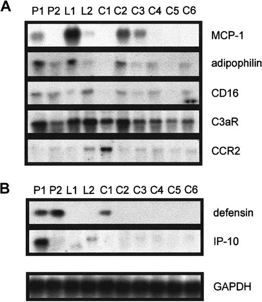 Fig. 1. Northern blot analysis in various individuals for the genes found to be differentially expressed between P1 and C1. / Elutriation-purified monocytes from patients with isolated Lp(a) hyperlipidemia (P1, P2), healthy controls with elevated Lp(a) (L1, L2), and 6 controls with low Lp(a) (C1 to C6) were incubated in 20% autologous serum for 18 hours, RNA was isolated, and 10 μg total RNA was used to investigate the expression of (A) MCP-1, adipophilin, CD16, C3aR, and CCR2 and (B) defensin and IP-10. Equal RNA loading was confirmed by reprobing the blots with GAPDH.