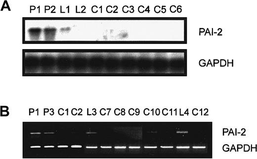 Fig. 2. Northern blot and semiquantitative PCR analysis of PAI-2 expression. / (A) Elutriation-purified monocytes from patients with isolated Lp(a) hyperlipidemia (P1, P2), healthy controls with elevated Lp(a) (L1, L2), and 6 controls with low Lp(a) (C1 to C6) were incubated in 20% autologous serum for 18 hours. RNA was isolated and 10 μg total RNA was used to investigate the expression of PAI-2. The film was exposed for 4 hours at −80°C to emphasize the difference in PAI-2 expression in the first 3 lanes. The blot was stripped and hybridized with a GAPDH probe. (B) RNA was prepared from monocytes of patients with isolated Lp(a) hyperlipidemia (P1, P3), healthy probands with elevated Lp(a) (L3, L4), and controls with low Lp(a) (C1, C2, C7, C8, C9, C10, C11, C12) as described in “Materials and methods.” The 100 ng RNA was used to amplify PAI-2 cDNA (20 cycles) or GAPDH cDNA (18 cycles).