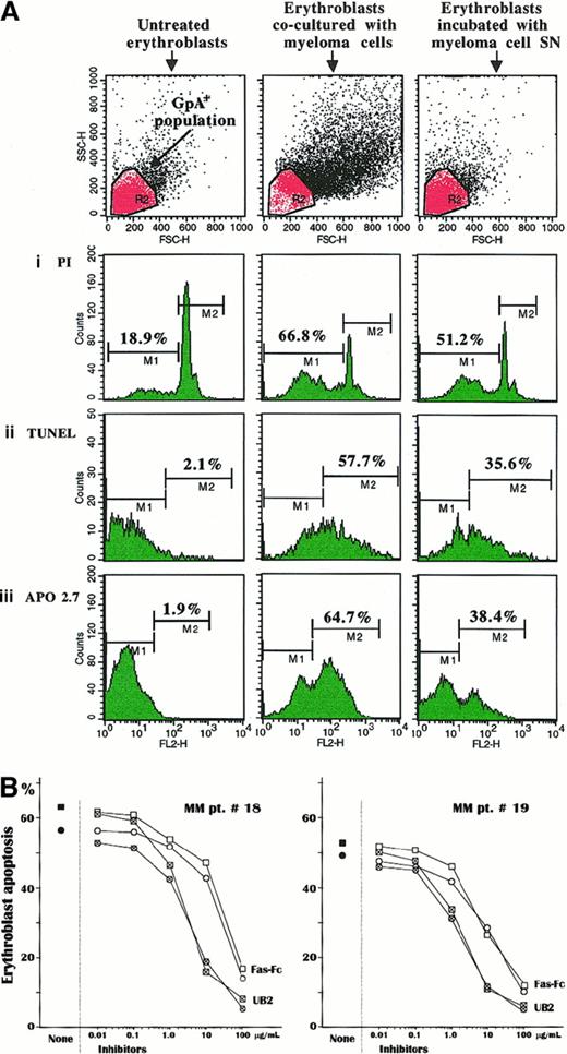 Fig. 4. Apoptotic effect exerted by Fas-L+ myeloma cells on erythroblasts. / (A) Cultured erythroblasts were measured in their spontaneous apoptosis (left panels) and after incubation with autologous myeloma cells at a 1:1 ratio (central panels) or with the relative SN (right panels). The cytofluorimetric pattern is related to the erythroblast culture of patient no. 16 and indicates a clear-cut increase of the subdiploid DNA erythroblast population (i) as well as an enlargement of both the TUNEL+ subset (ii) and the cell population expressing the mitochondrial APO2.7-reactive antigen, an early marker of apoptosis (iii). A similar, though slightly lower, effect was obtained with the myeloma cell–conditioned SN. The upper section includes the erythroblast populations gated to the cytofluorimetric analysis. (B) Inhibition experiments by PI staining (■) and TUNEL (○) measurements of the apoptogen potential of myeloma cells by preincubation of either erythroblasts or plasma cells with a nonagonist MoAb to Fas (UB2) or with the Fas-Fc construct, respectively. These inhibiting tests of erythroblast apoptosis were completed in 2 patients with advanced MM. Pretreatment with both reagents induced a progressive saturation of the binding sites of Fas on erythroblasts and, alternatively, of Fas-L on plasma cells, leading to exhaustion of the apoptosis induction through Fas/Fas-L pathway. This effect was dose-dependent and promptly induced by blocking Fas on erythroblasts, with amounts of UB2 higher than 1 μg/mL in culture medium. By contrast, saturation of Fas-L on plasma cells required a nearly 10-fold higher concentration of Fas-Fc to produce a similar effect in cultured erythroblasts from both patients.