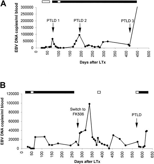 Fig. 2. EBV DNA load dynamics in unfractionated whole blood of PTLD patient nos. 1 and 2. / (A) Patient no. 1 developed 3 episodes of PTLD after primary EBV infection, all preceded by increased EBV DNA loads. (B) Patient no. 2 was converted from cyclosporine A to FK506 as therapy for chronic rejection, which was followed by dramatically increasing EBV DNA loads that fluctuated strongly. EBV+ plasmacytoma in the mouth was diagnosed approximately 300 days later. Black boxes indicate acyclovir treatment and white boxes indicate gancyclovir treatment.