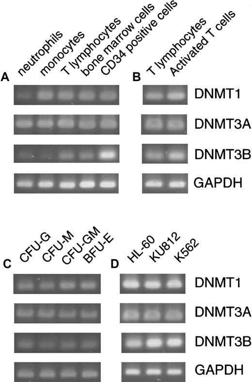 Fig. 1. Expression of. / DNMTs in normal hematopoiesis and leukemia cell lines. Expression of DNMTs was assayed by a standard RT-PCR method in normal peripheral cells and bone marrow cells (A), resting and PHA-activated T cells (B), various colonies formed in hematopoietic progenitor assays (C), and 3 leukemia cell lines (D). With the cells other than the hematopoietic progenitor colonies, PCR amplification was performed for 26 cycles for GAPDH (a housekeeping control), 30 cycles for DNMT1 and3A, and 35 cycles for DNMT3B (A,B,D). To amplify transcripts from the picked hematopoietic colonies, PCR was performed for 35 cycles for DNMT1, 3A, andGAPDH, and 40 cycles for DNMT3B.