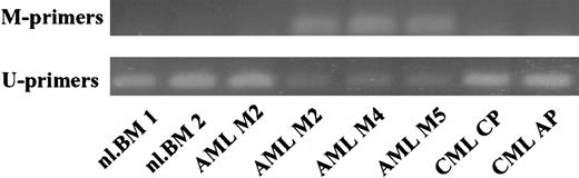 Fig. 6. Methylation-specific PCR for the p15INAK4Bpromoter in normal bone marrow cells and leukemia samples. / Three of the 4 AML cases gave the methylation-specific PCR band, whereas normal bone marrow cells and CML cases showed only the unmethylated DNA-specific band. M-primer indicates primers specific for methylated DNA; U-primers, primers specific for unmethylated DNA.