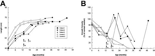 Fig. 2. Growth profiles of OI patients and controls from birth to the most recent assessment. / (A) Absolute growth in cm. (B) Growth velocity is defined as the difference between the first and last measurement of each interval, reported as a percentage of the median growth velocity for age- and sex-matched healthy children.21 Controls were children with OI who did not receive specific therapy during the observation period. Each symbol represents a crown-to-heel measurement. Arrows indicate the times of transplantation for patients (P).