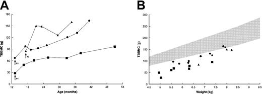 Fig. 3. Changes in TBBMC after BMT. / (A) Absolute measurements by dual-energy x-ray absorptiometry. Patient no. 2 had progressive increases in TBBMC after the placement of intramedullary rods at 29 months of age. (B) TBBMC as a function of body weight. The shaded area represents the normal range (mean ± 2 SD) of measurements for weight-matched healthy children.22Data for control patients were not available. Arrows indicate the times of transplantation. Symbols correspond to those in Figure 2.