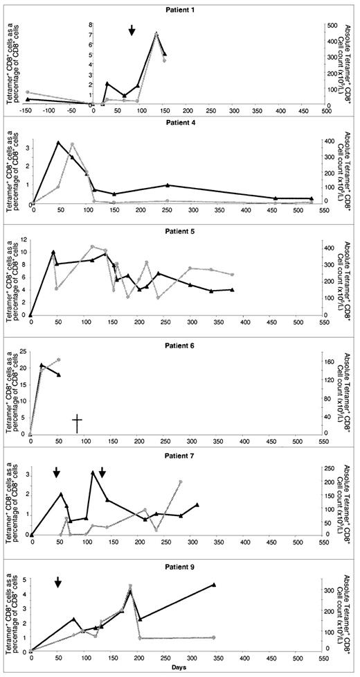 Fig. 2. Reconstitution of CMV-specific CTL in CMV-seropositive patients given transplants from CMV-seropositive sibling donors. / Results in 6 individual patients are shown. The number of days after transplantation is shown on the x-axis. The percentage of CD8+ T cells binding HLA-peptide tetramer (▴) and the absolute CMV-specific CTL count () are shown on the y-axes. Times of CMV reactivation are shown by arrows.