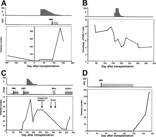 Fig. 5. Examples of CMV-specific immune reconstitution in individual patients. / (A) In patient 1, CMV-specific CTL were detected on day 33 but were at low levels during prolonged treatment with prednisolone. After an episode of CMV reactivation on day 82 and a short course of ganciclovir therapy, the number of CMV-specific CTL increased to a high level. A CTL assay done 4 months before transplantation had shown that CTL numbers were considerably lower than those observed after recovery from reactivation. (B) Patient 5 had early and sustained immune reconstitution, but the percentage of tetramer-binding CTL fell from 9.8% of CD8+ T cells to 5.7% after the introduction of prednisolone for control of GVHD. A similar reduction in CTL numbers was also observed (data not shown). (C) Patient 10 received stem cells from an unrelated donor, and no CTL were detectable until day 116. After a second episode of CMV reactivation on day 126, CTL increased to levels of 70 × 105/L. A course of prednisolone therapy suppressed CTL numbers and, following recovery, CTL were virtually eliminated after unsuccessful donor leukocyte infusions and chemotherapy for cytogenetic relapse of chronic myeloid leukemia. Introduction of the tyrosine kinase inhibitor STI571 was associated with recovery of CTL numbers. (D) Patient 12 also received stem cells from an unrelated donor. After an early period of CMV reactivation, the patient was given a prolonged course of ganciclovir therapy. CMV-specific CTL were detected only after discontinuation of the drug. P indicates prednisolone; GCV, ganciclovir; vertical lines with CMV Ag+, episode of CMV reactivation; mito, mitoxantrone; and STI571, tyrosine kinase inhibitor. The x-axis represents days after transplantation. All drug doses are in milligrams. Cell numbers on the y-axis are × 105/L cells.