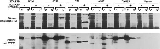 Fig. 4. Characterization of mutant STAT5B. / Wild-type as well as mutant STAT5B with hGM-CSFR α and βc subunits were transfected to COS7 cells. After 2 days of culture, the cells were stimulated with hGM-CSF (10 ng/mL) for 30 minutes and harvested. Cells were separated into soluble and nuclear fractions, and phosphorylation and translocation of STAT5 were analyzed by Western blotting.