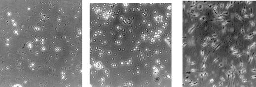 Fig. 8. Egr-1 enhances macrophage differentiation in BM cells of sublethally irradiated mice. / Eight days after transplantation, BM cells were recovered from femurs and 0.3 × 106 cells/mL were seeded in liquid culture medium supplemented with IL-3 (10% WEHI-3B–conditioned medium). After 3 days, the percentage of adherent cells was determined (see Table 2, “Adherent cells”). Values are the average of triplicate plates (SD up to ± 15%).