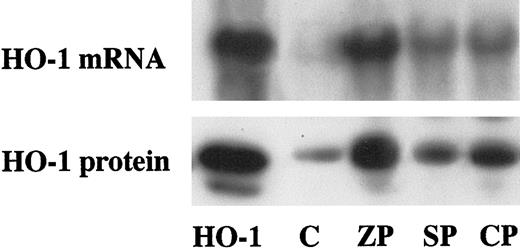 Fig. 1. HO-1 expression in HA-1 cells incubated with 10 μM MPs for 24 hours. / Upper panel shows a representative example of 3 Northern blots of HO-1 mRNA. Lower panel shows a representative example of 3 Western blots of HO-1 immunoreactive protein. Lane HO-1 is HO-1 standard obtained from rat livers injected with COCl2; lane C, untreated control; lane ZP, cells incubated with ZnPP; lane SP, cells incubated with SnPP; lane CP, cells incubated with CrPP.