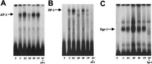 Fig. 4. AP-1, SP-1, and Egr-1 binding in nuclear extracts from HA-1 cells incubated with 100 μM ZnCl2 or 10 μM MPs for 24 hours. / Each panel represents an electrophoretic mobility shift gel from 3 separate experiments. (A) AP-1 binding. Lane F, free probe; lane C; untreated control; lane ZC, cells incubated with ZnCl2; lane ZP, cells incubated with ZnPP; lane SP, cells incubated with SnPP; lane CP, cells incubated with CrPP; lane ZC+AP-1, ZnCl2treated cells incubated with a 100-fold excess of cold AP-1 probe to demonstrate specificity of binding. (B) SP-1 binding. Lane F, free probe; lane C, untreated control; lane ZC, cells incubated with ZnCl2; lane ZP, cells incubated with ZnPP; lane CP, cells incubated with CrPP; lane SP, cells incubated with SnPP; lane ZC+SP-1, ZnCl2 treated cells incubated with a 100-fold excess of cold SP-1 probe to demonstrate specificity of binding. (C) Egr-1 binding. Lane F, free probe; lane C, untreated control; lane ZP, cells incubated with ZnPP; lane ZC, cells incubated with ZnCl2; lane CP, cells incubated with CrPP; lane SP, cells incubated with SnPP; lane ZP+Egr-1, ZnPP-treated cells incubated with a 100-fold excess of cold Egr-1 probe to demonstrate specificity of binding. In each gel, cold competition was performed with the compound leading to the highest nuclear protein binding.