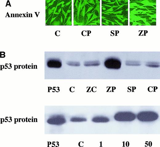 Fig. 10. Markers of apoptosis in MP-incubated cells. / (A) A representative slide of immunoreactive annexin V detection in cultured HA-1 cells incubated with 10 μM MPs for 24 hours. Four slides in each group were incubated with annexin V antibody and FITC as described in “Materials and methods.” All images were obtained at the same intensity to allow for comparison. Lane C, untreated controls; lane CP, cells incubated with CrPP; lane SP, cells incubated with SnPP; lane ZP, cells incubated with ZnPP. (B) Upper panel shows representative example of 2 Western analyses for immunoreactive p53 protein content in HA-1 cells after 10 μM MP incubation. Lane p53, p53 protein standard obtained from human 293 cells; lane C, untreated controls; lane ZC, cells incubated with 100 μM ZnCl2; lane ZP, cells incubated with ZnPP;lane SP, cells incubated with SnPP; lane CP, cells incubated with CrPP. Lower panel indicates that p53 protein induction was dose dependent on ZnPP concentration. Lane p53, p53 protein standard obtained from human 293 cells; lane C, untreated controls; lane 1, cells incubated with 1 μM ZnPP; lane 10, cells incubated with 10 μM ZnPP; lane 50, cells incubated with 50 μM ZnPP.