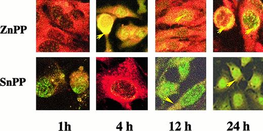 Fig. 11. Nuclear localization of ZnPP and SnPP in HA-1 cells. / Representative pseudoimages of fluorescent signal for MPs and immunoreactive p53. Three slides in each group were incubated with ZnPP or SnPP then incubated with p53 antibody and FITC-labeled secondary antibody as described in “Materials and methods” and analyzed at various time points. The MPs were visualized using their endogenous fluorescence by setting excitation at 568 nm and emission at more than 590 nm, and FITC was detected by setting the excitation at 488 nm and the emission at 515 to 545 nm. Upper panel is ZnPP-incubated HA-1 cells. Lower panel shows SnPP-incubated HA-1 cells. Lane 1h, 1-hour incubation with MP; lane 4h, 4-hour incubation with MP; lane 12h, 12-hour incubation with MP; lane 24h, 24-hour incubation with MP. The yellow arrows represent colocalization of MPs and p53; the orange arrow represents the endogenous fluorescence of the MPs; the green arrow represents the p53 signal. In the SnPP-treated cells, the FITC signal was further enhanced to allow for visualization of p53 within the nucleus. Note the nuclear colocalization of ZnPP and p53 and the lack of nuclear colocalization of SnPP and p53. CrPP could not be visualized due to a lack of endogenous fluorescence.