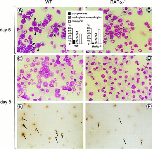 Fig. 4. Accelerated differentiation of RARα−/− granulocytes in GM-CSF–dependent clonogenic cultures. / We plated 5 × 104 BM cells in methylcellulose medium containing 50 ng/mL GM-CSF. (A-D) Pooled cells from all the colonies developing on a dish (about 70 colonies) were cytocentrifuged onto a glass slide and stained with May-Grünwald-Giemsa. Arrowheads in panel A indicate promyelocytes that are numerous on slides from day-5 WT cultures, but are less frequent in mutant samples. The inset in panels A and B corresponds to the scoring of approximately 400 cells of the granulocyte lineage for each case. (E,F) Typical colonies from culture dishes at day 8; note the reduction in the number and size of dense cellular aggregates (arrows), which correspond to granulocytes.
