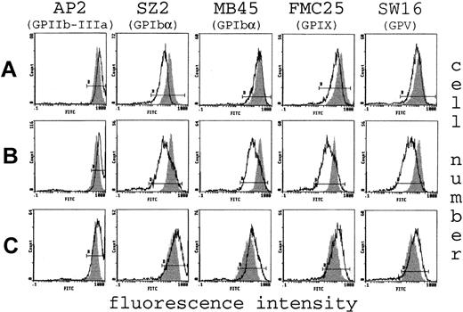 Fig. 2. Flow cytometry analysis of platelet GPs. / Tracings of flow cytometry with mAbs against GPIIb/IIIa, GPIbα (SZ2 and MB45, the conformational-dependent and -independent mAb, respectively), GPIX, and GPV of 3 patients, each representative of a distinct group. At the genotype level patient A carries the Bolzano mutation, whereas patients B and C do not have the mutation. In each patient (white curve), the expression of GPIIb/IIIa on the platelet surface was increased compared to that of the healthy control (gray curve), as shown by shifting of the curves to the right. In contrast, single components of the GPIb/IX/V complex were variously reduced in patients A and B. These patients have a GP profile consistent with a heterozygous BSS phenotype. Of particular interest is the different fluorescence obtained with SZ2 and MB45 mAbs in the Bolzano patient, suggesting the presence of a conformationally changed GPIbα protein. Patient C shows a clear increase of all GP because of the larger volume of platelets and thus represents the “true” thrombocytopenia- affected patient.