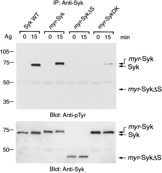 Fig. 4. Deletion of the SH2 domains abrogates the FcεRI-mediated tyrosine phosphorylation of plasma membrane–associated Syk. / Cell lines expressing different forms of Syk were stimulated with antigen (Ag), and cell lysates were then immunoprecipitated with anti-Syk antibody. Immunoprecipitates were analyzed by immunoblotting with antiphosphotyrosine (pTyr) (top) and anti-Syk antibodies (bottom). Similar results were obtained when the other cloned lines were tested in 5 independent experiments.