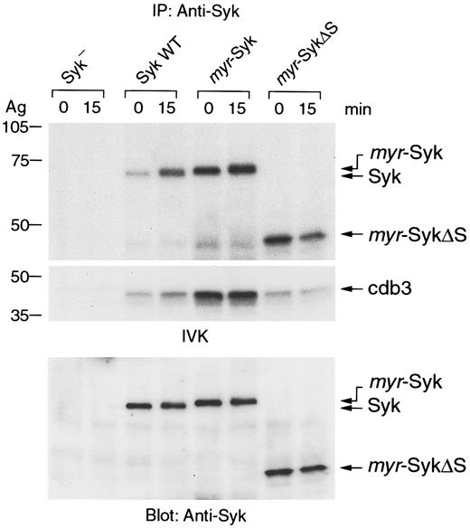 Fig. 5. Effect of Syk mutation on its intrinsic kinase activity. / Syk was immunoprecipitated from antigen-stimulated (Ag) or nonstimulated cells and tested by the in vitro immune-complex kinase (IVK) assay. Radiolabeled proteins were detected by autoradiography (top, autophosphorylation of Syk; middle, phosphorylation of the substrate cdb3). Amounts of precipitated proteins were confirmed by anti-Syk immunoblotting (bottom). Similar results were obtained when the other cloned lines were tested in 4 independent experiments.
