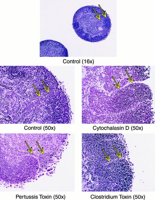 Fig. 9. Histologic sections of thymic lobes treated with inhibitors of motility. / Lobes were treated as in Figure 8, imbedded and stained with hematoxylin and eosin. Magnification is indicated in parentheses. Arrows indicate tracks of lymphoid cells that may represent a route of emigration, and show that in cytochalasin D or Clostridiumtoxin groups, these tracks are relatively empty, whereas in the pertussis toxin-treated group the tracks are relatively congested.