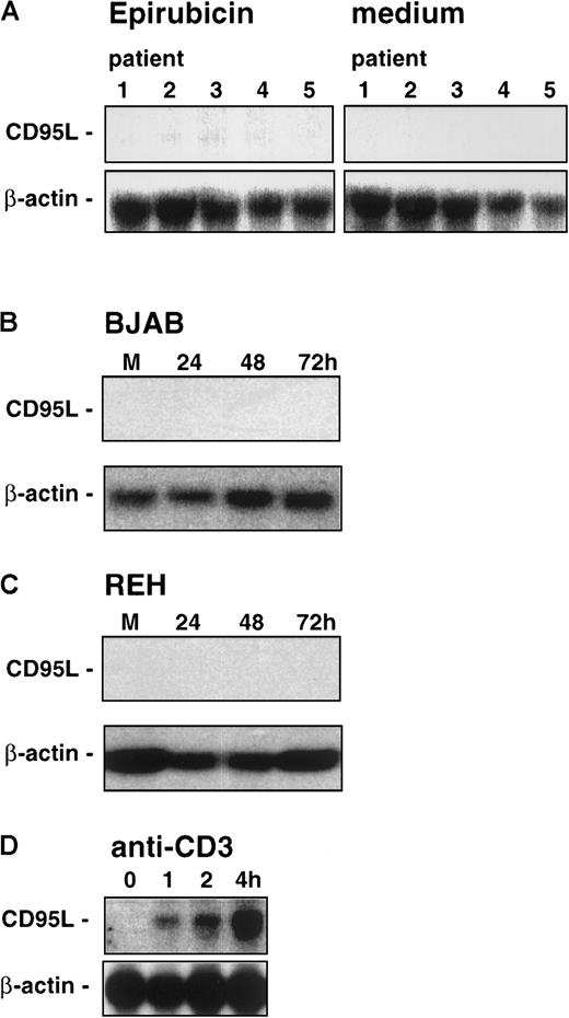 Fig. 5. Northern blot analysis of CD95/Fas ligand expression in epirubicin-induced cells. / Leukemic cell samples of 5 patients (the same as in Table 1) with childhood B-lineage ALL (A) were induced for 24 hours in the presence of epirubicin (0.1 μg/mL) or medium alone. BJAB (B) or REH cells (C) were induced for 24 to 72 hours in the presence of epirubicin. M, medium control at 72 hours. (D) As a positive control for the induction of CD95/Fas ligand expression, Jurkat T cells were cultured in the presence of plastic-immobilized anti-CD3 monoclonal antibody OKT3 for 0, 1, 2, or 4 hours. To control for equal amounts and the integrity of the RNA, the blots were rehybridized with a cDNA probe for β-actin.