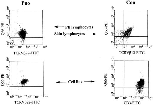 Fig. 1. Detection of p140/KIR3DL2 molecules on CTCL cell lines and on fresh tumor lymphocytes. / Two long-term CTCL tumor lines (Pno, Cou-L) and fresh tumor cells isolated from the blood of patient Pno (PB lymphocytes–Pno) and from tumoral skin fragments of patient Cou (skin lymphocytes) were analyzed by 2-color immunofluorescence and FACS analysis with the indicated mAbs followed by isotype-specific fluorescein isothiocyanate or phycoerythrin-conjugated goat antimouse second reagents.67 Contour plots were divided into quadrants representing unstained cells (lower left), cells with only red fluorescence (upper left), cells with red and green fluorescence (upper right), and cells with only green fluorescence (lower right).
