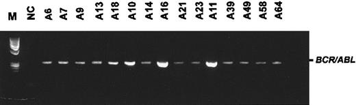 Fig. 1. First detection of. / BCR/ABL transcripts in PB by using RT-PCR.Animals were detected as positive at an average age of 163 days (range, 128-262 days). The figure shows the first positive PCR for each mouse included in the study. M, φX/HaeIII marker; NC, negative control. The numbers above the lanes designate an individual animal.