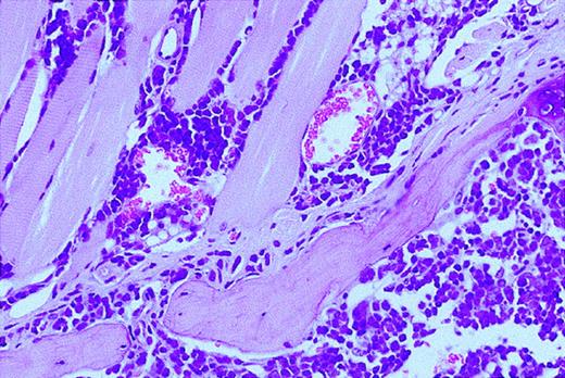 Fig. 3. Leukemia/lymphoma in control group. / A sagittal section is shown of the sternum of mouse A21. This mouse was treated for 64 days with the vehicle and then killed when terminally ill. A homogeneous infiltration of the bone marrow and the surrounding muscular tissue is seen with intermediate-sized lymphoid cells with round nuclei, large central nucleolus, immature chromatin pattern, and a scant rim of cytoplasm representing pre-B leukemic cells.