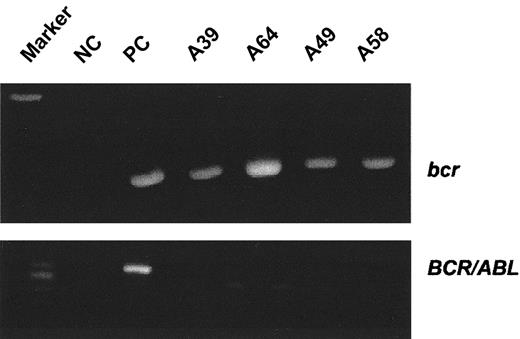 Fig. 4. The 4 surviving SCH66336-treated mice did not express. / BCR/ABL in PB on the last day of treatment. RNA was subjected to RT-PCR using either control bcr primers (top panel) or BCR/ABL P190 primers (bottom panel). NC, negative control; PC, positive control. The numbers above the lanes refer to the individual animals in the treatment group.