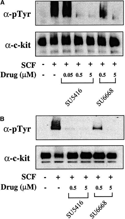 Fig. 6. SU5416 and SU6668 inhibit c-kit tyrosine phosphorylation in AML blast cells. / AML blast cells (panel A: patient No. 1; panel B: patient No. 8) were quiesced by serum starvation and treated with the indicated concentrations of SU5416 for 1 hour or SU6668 for 24 hours prior to stimulation with 250 ng/mL SCF for 15 minutes. Cells were harvested, lysed, and immunoprecipitated with an anti–c-kit antibody. After SDS-PAGE and transfer to nitrocellulose, the blots were probed with an antiphosphotyrosine antibody (top) and subsequently stripped and reprobed with an anti–c-kit antibody (bottom).