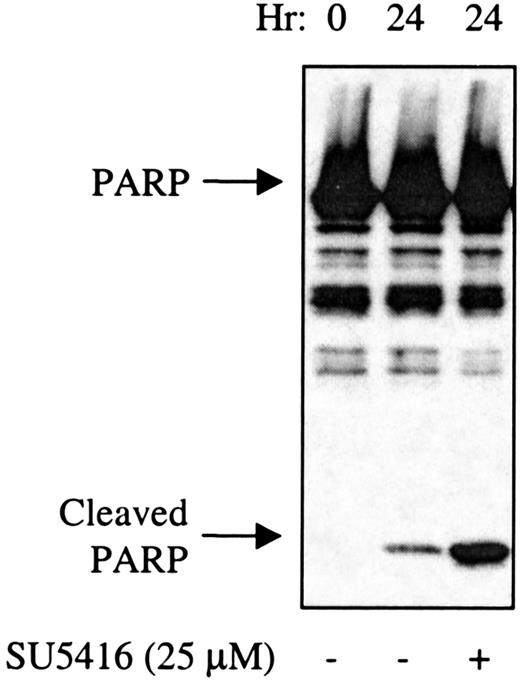 Fig. 9. SU5416-treated AML blast cells demonstrate increased cleavage of PARP. / AML blasts (patient No. 1) in medium containing 10% FBS were pretreated with SU5416 for 1 hour prior to incubation with 100 ng/mL SCF. At 24 hours, cells were lysed and proteins separated by SDS-PAGE. After transfer to nitrocellulose, the blots were probed with an anti-PARP antibody. The full-length 116-kd PARP and the 26-kd cleaved PARP fragment are indicated.