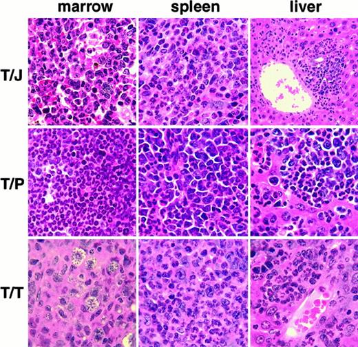 Fig. 2. Histopathology of MPD induced by tyrosine kinase fusions in the absence of GM-CSF and IL-3. / TEL/JAK2 (T/J), TEL/PDGFβR (T/P), TEL/TRKC (T/T). MPD is manifested in each case by destructive infiltration of the liver, and replacement of normal hematopoietic elements in the bone marrow and spleen by myeloid lineage cells, including many mature granulocytes. The T/J liver panel is magnified at low power (10×), all other panels are magnified at high power (100×). All panels are views of tissues stained with hematoxylin and eosin.