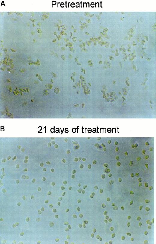 Fig. 7. Changes in SAD mouse RBC morphology by NS3623. / Representative pictures of RBCs drawn from a SAD mouse and fixed in formalin, before (A) and after (B) 3 weeks of PO treatment with NS3623 (2 × 100 mg/kg per day).