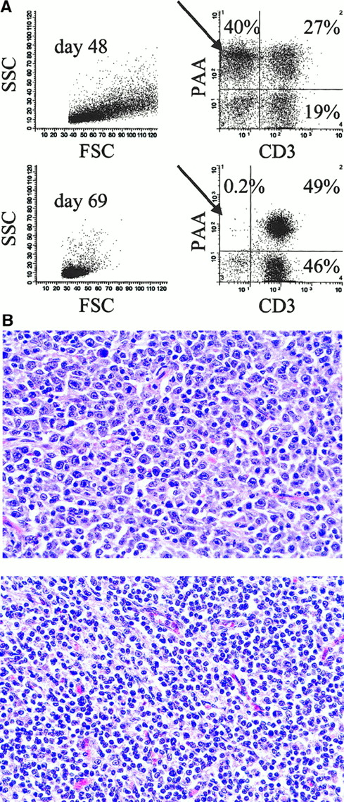 Fig. 2. Resolution of PTLD after CyA cessation in animal no. 13 629. / (A) Two-color staining and flow cytometry (CD3 versus PAA) of lymph node cells during PTLD (day 48) and following complete resolution of PTLD (day 69). PAA is a marker of donor-type cells (see “Results” and “Materials and methods”). Forward scatter (FSC), side scatter (SSC), pig allelic antigen (PAA). (B) Hematoxylin and eosin staining of mesenteric lymph node tissue taken on day 48 (top) and day 69 (bottom). Typical polymorphous PTLD with a mixture of immunoblasts, plasmacytoid cells, and plasma cells can be seen in the day 48 but not the day 69 sample (original magnification × 500).