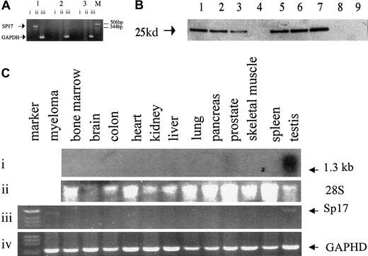 Fig. 1. Analysis showing that Sp17 is expressed in myeloma cells and only in normal testis. / (A) PCR analysis using a pair of sequence-specific primers for Sp17 produced a positive signal of around 500 bp. Lane 1 shows Sp17-positive myeloma bone marrow; lane 2, Sp17-negative myeloma bone marrow; lane 3, normal bone marrow; M, molecular marker. Lane i shows PCR of DNAse I-treated RNA; lane ii, PCR of RNA that had undergone RT; lane iii, control amplification for GAPDH gene segment. (B) Western blot analysis showing the expression of Sp17 protein in myeloma cells and not normal bone marrow cells. Lanes 1 through 6 show lysates from fresh myeloma cells; lane 7, lysate from ARK-B myeloma cell line; lanes 8 and 9, lysates from normal bone marrow. (C) Northern blot and RT-PCR analysis of RNA from a panel of normal tissue. Panel i shows a strong signal, of approximately 1.3 kb, in normal testis and a weak signal in normal prostate detected in Northern blot analysis; panel ii, 28S ribosomal RNA; panel iii, RT-PCR showing Sp17 transcripts in only normal testis and a myeloma tumor cell RNA; panel iv, control amplification for GAPDH gene segment.