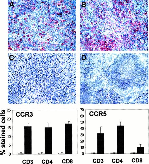 Fig. 2. CCR3 and CCR5 expression in HD and control lymph nodes. / Immunohistochemical staining of lymph nodes involved by HD with mAb directed against CCR5 (A), CCR3 (B), and isotype-matched control antibody (C). No CCR5 expression is detectable in control lymph nodes with follicular hyperplasia (D). Graphs show percentage of CCR5- and CCR3-expressing cells in T-cell subsets sorted from control (■) and HD lymph nodes (▪). The graphs represent the mean percentage (SE) of stained cells of 5 distinct experiments.