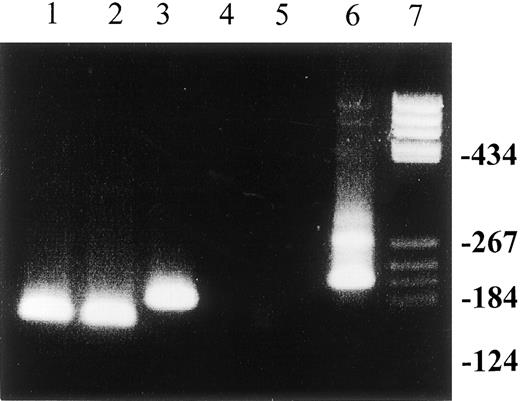 Fig. 2. The effect of antiviral treatment on t(14;18) translocation in patients with chronic HCV infection. / Detection of t(14;18) translocation by MBR bcl-2/JH nested PCR in PBMCs from patients with chronic HCV infection before and after antiviral treatment. Lanes 1 and 2: pretreatment t(14;18) translocation in this patient persisted upon completion of antiviral treatment. The patient had no virologic response; lanes 3 and 4: loss of pretreatment t(14;18) translocation in a patient who also had a virologic response to combination treatment with interferon-α and ribavirin; lane 5: negative control; lane 6: positive control (sample from a patient with follicular B-cell lymphoma); lane 7: molecular weight marker. PCR products were separated on 6% acrylamide gel.