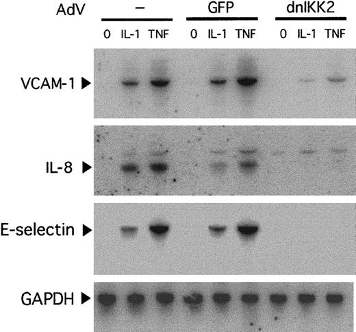 Fig. 3. Northern blot analysis of inflammatory markers. / HUVECs were transduced with AdV-dnIKK2 or control virus (AdV-GFP) or left without virus and after 2 days stimulated with IL-1 or TNFα for 4 hours as indicated. VCAM-1–, IL-8–, and E-selectin–specific bands are indicated. Equivalent loading and transfer of RNA was confirmed by hybridization with GAPDH.